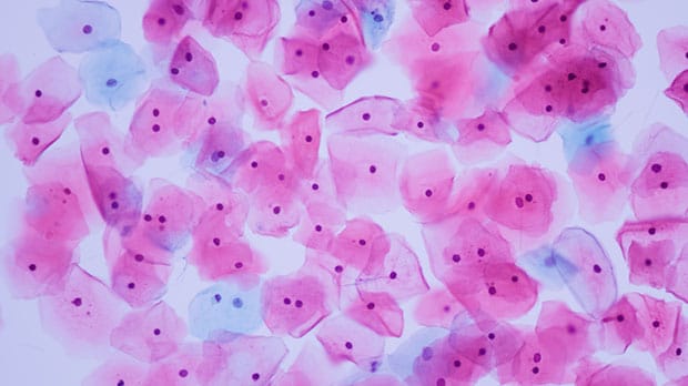 HPV can cause numerous kinds of cancer, yet many people don't realize it
