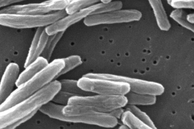 WHO calls for immediate action as report shows 10% rise in child TB infections in European region